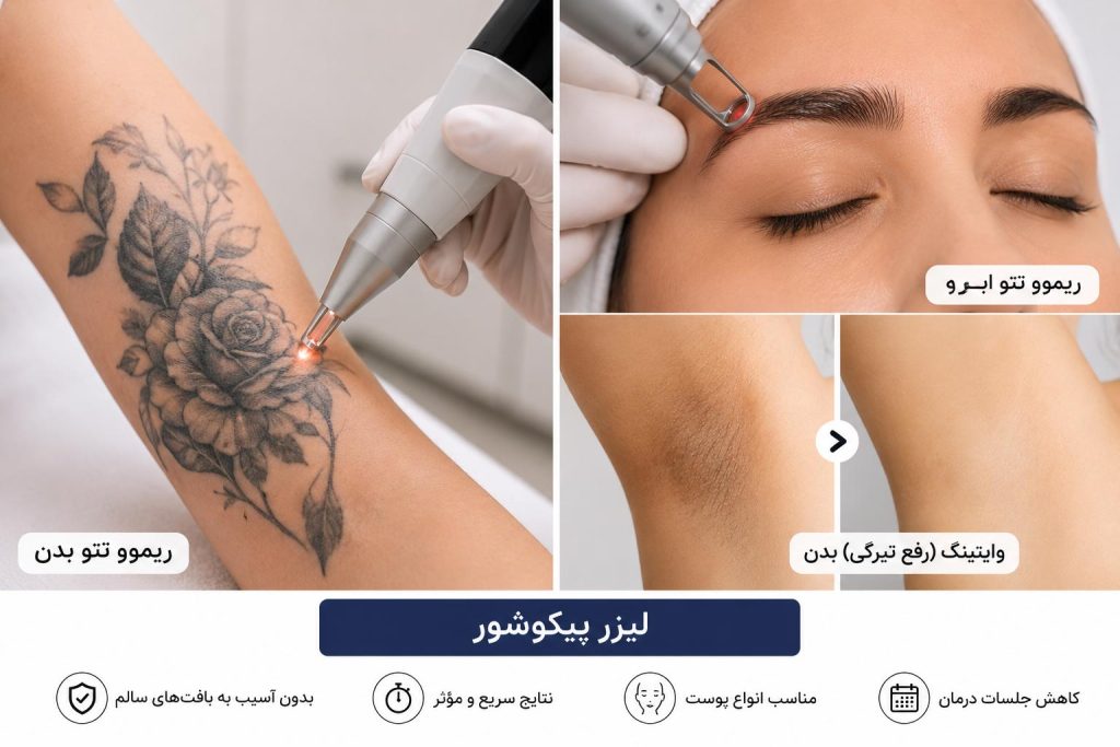 لیزر پیکوشور